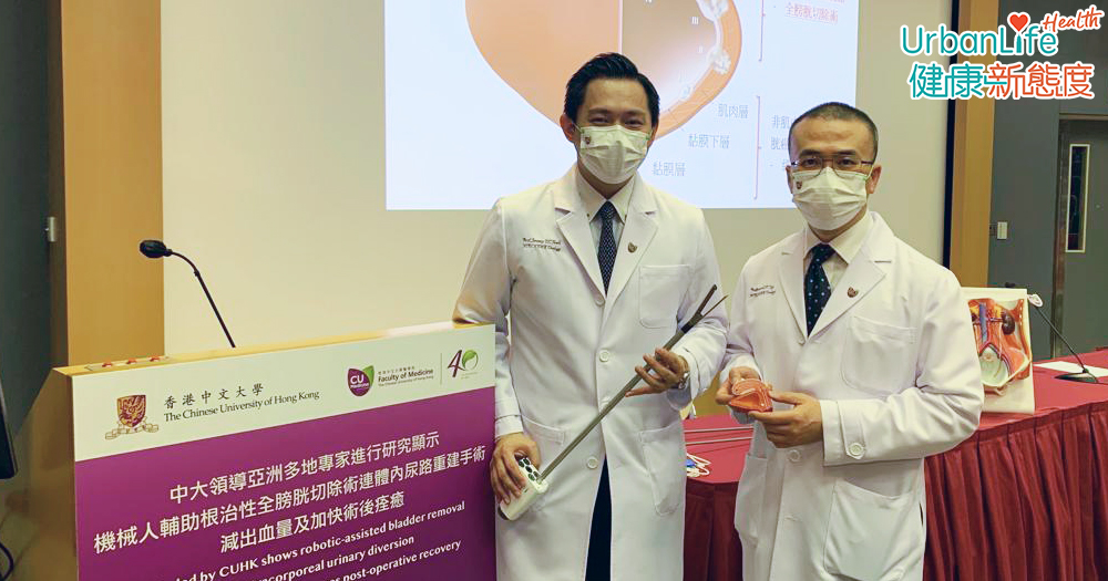 中大研究發現,透過手術機械人將整個膀胱切除後,再用微創方式進行體內尿路重建,可減出血量及縮短住院時間,且不會增加併發症風險。