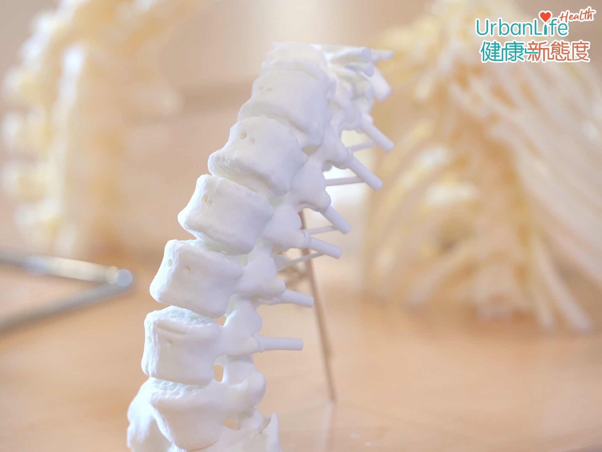 高日藍醫生指,脊柱側彎是人的脊柱,不正常的三維畸形。