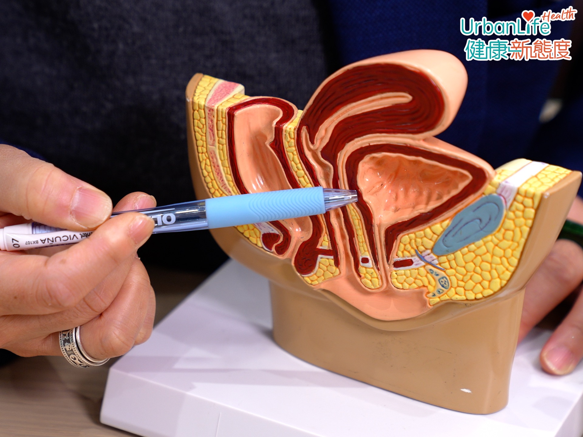 張醫生提到,夜尿原因很多,喝水習慣、糖尿控制不善、睡眠窒息症等,都有機會導致夜尿。亦可能是患上一些泌尿科疾病,例如前列腺肥大、膀胱發炎等。