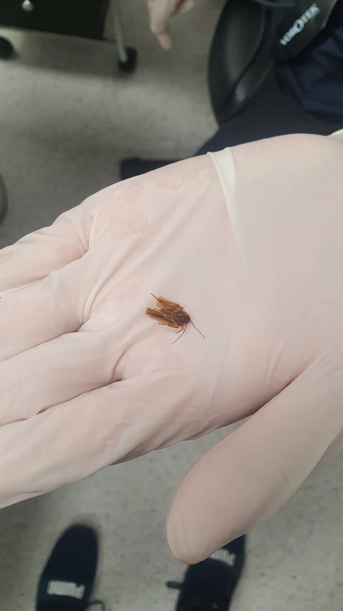 醫生花了幾分鐘的時間才把「蟲子」夾出來,卻夾出蟑螂的上半身,這讓他非常害怕,幸好最後藉由儀器順利把蟑螂的下半身也吸出來了。