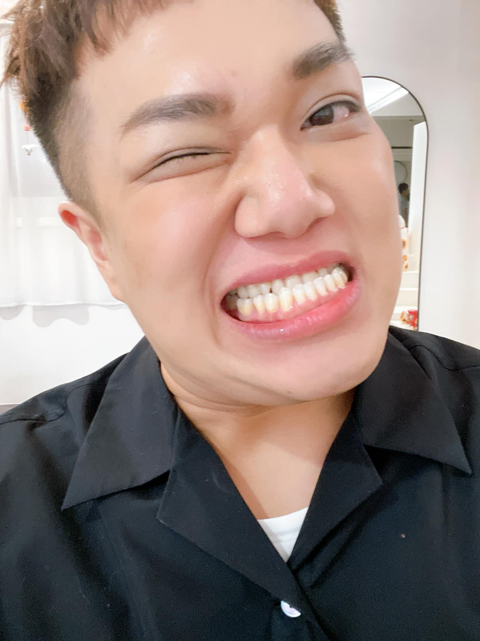 關韶文從小就知道自己的下排牙齒長在外面，在他要當記者的前一個月，甚至瞞著家人看牙醫，希望能有一道曙光。