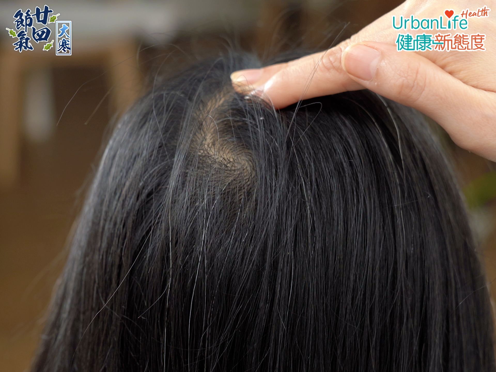 壓力大、睡得不好時可按摩「百會穴」。