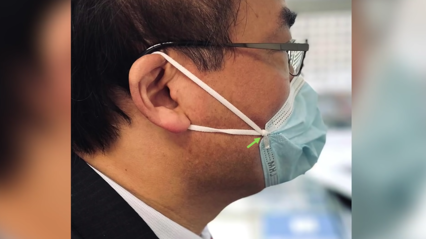 方法二：於外科口罩兩邊的各打一個結。