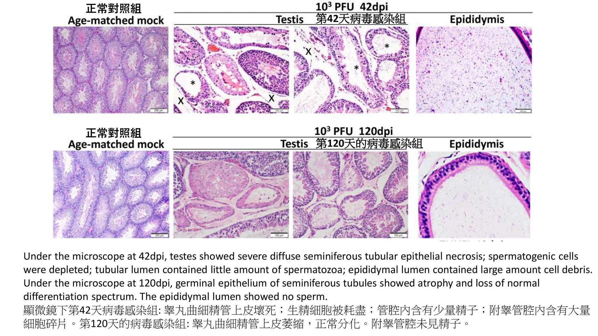 港大研究發現,感染新冠肺炎的倉鼠,在42至120日後睪丸萎縮,尺寸和重量下降,同時體內的性激素水平顯著降低。