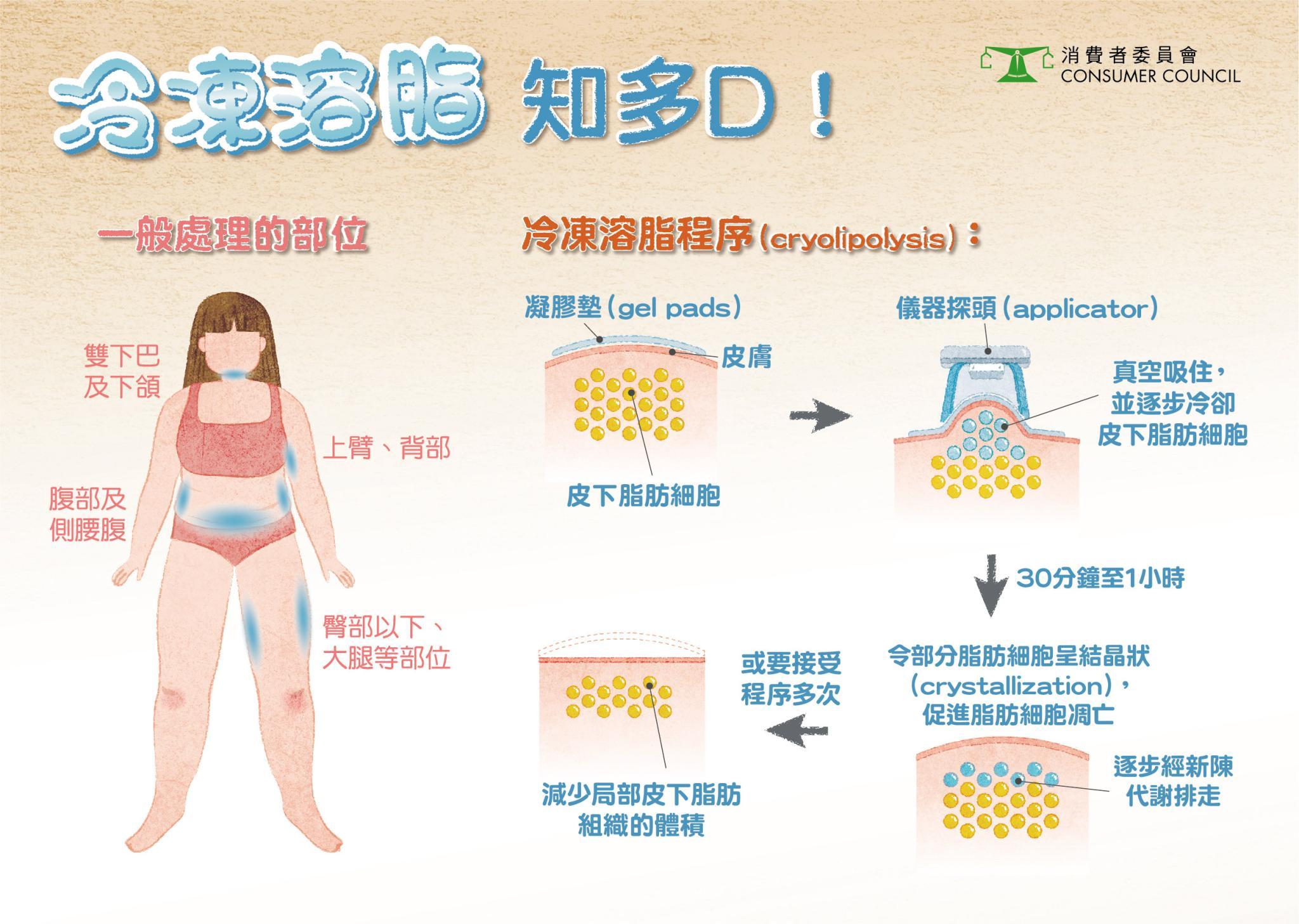 「冷凍溶脂」原理。