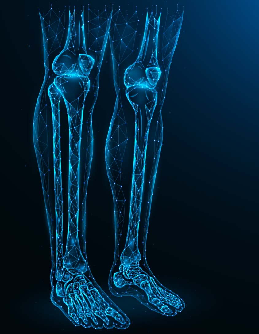 骨骼延長手術又名「斷骨增高手術」，是由蘇聯醫生伊里扎洛夫（Gavril Ilizarov）在二次大戰之後治療受傷士兵的時候開創的。