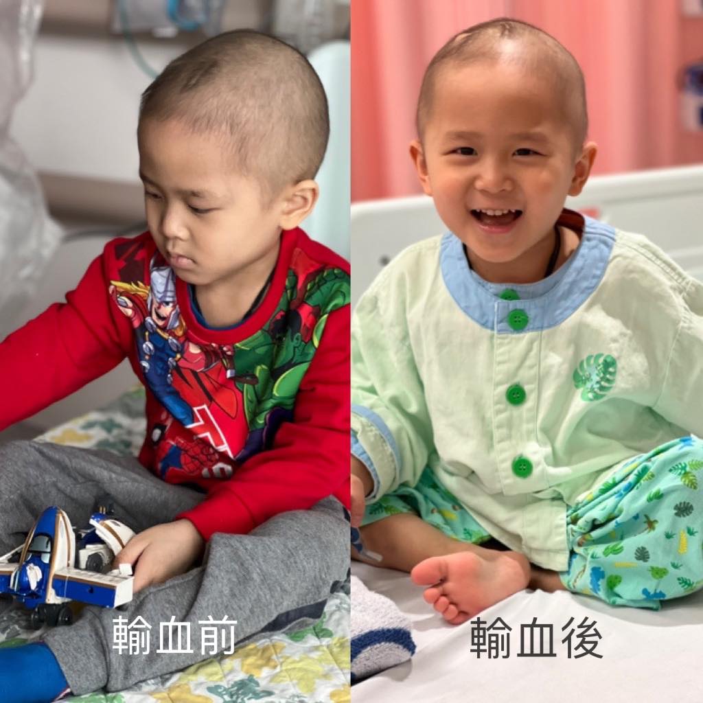 4歲患罕見癌症男童Sheldon近日再入院做新一輪的治療。