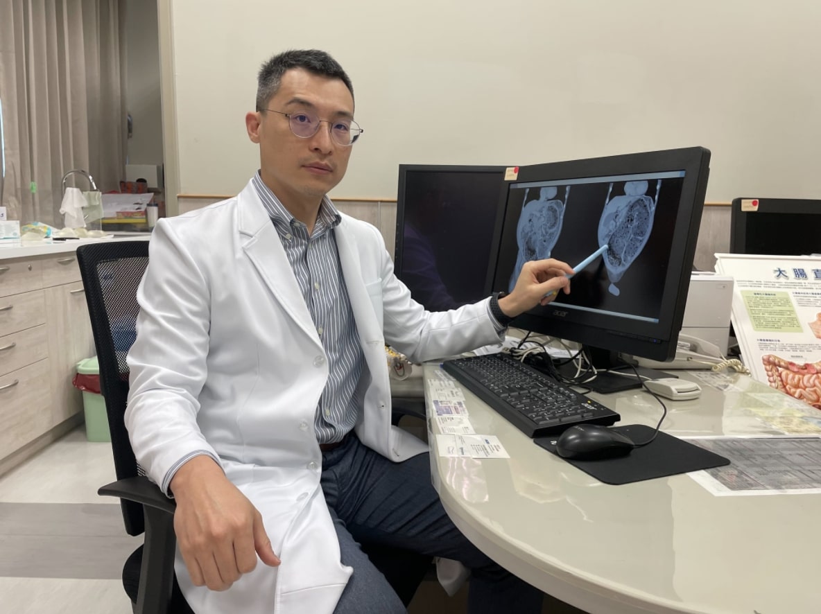 張巨成醫生先幫病患做肛門指檢，亦發現有石頭般的重物壓在患者的骨盆腔。