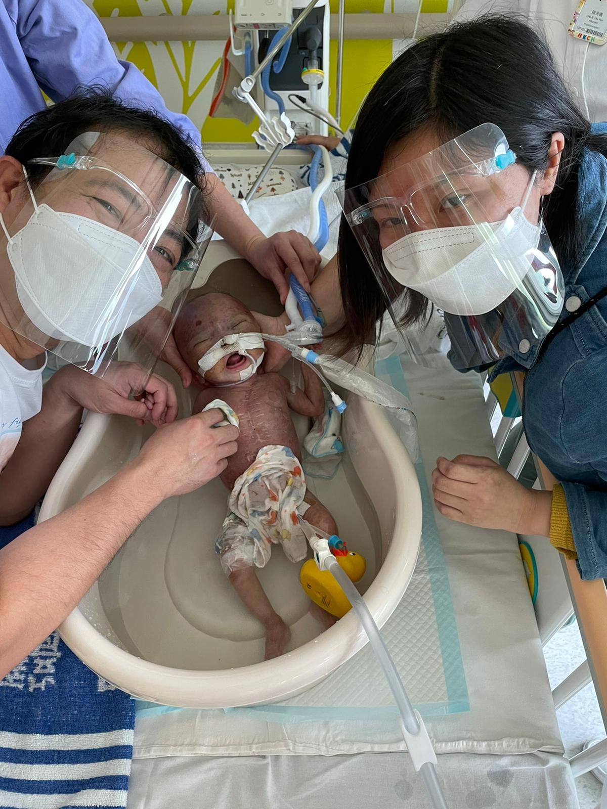 11個月大、先天性大血管移位BB允祈情況轉差,其父母忍痛決定放棄治療。