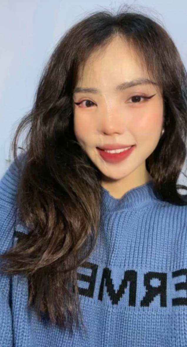 雖然臉部仍有淡淡的傷痕,但她已重捨自信心。