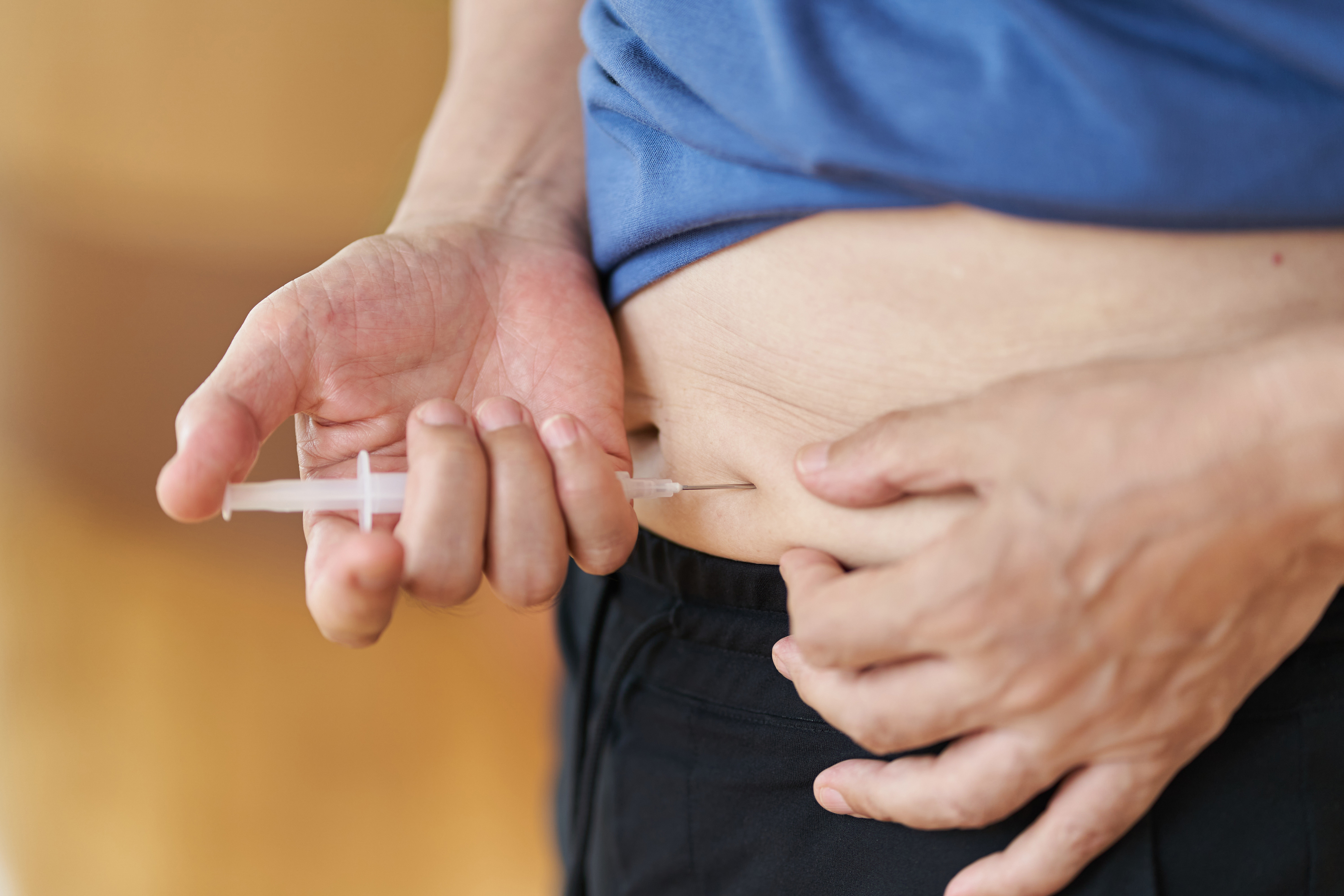 1型糖尿病是一種自身免疫疾病。