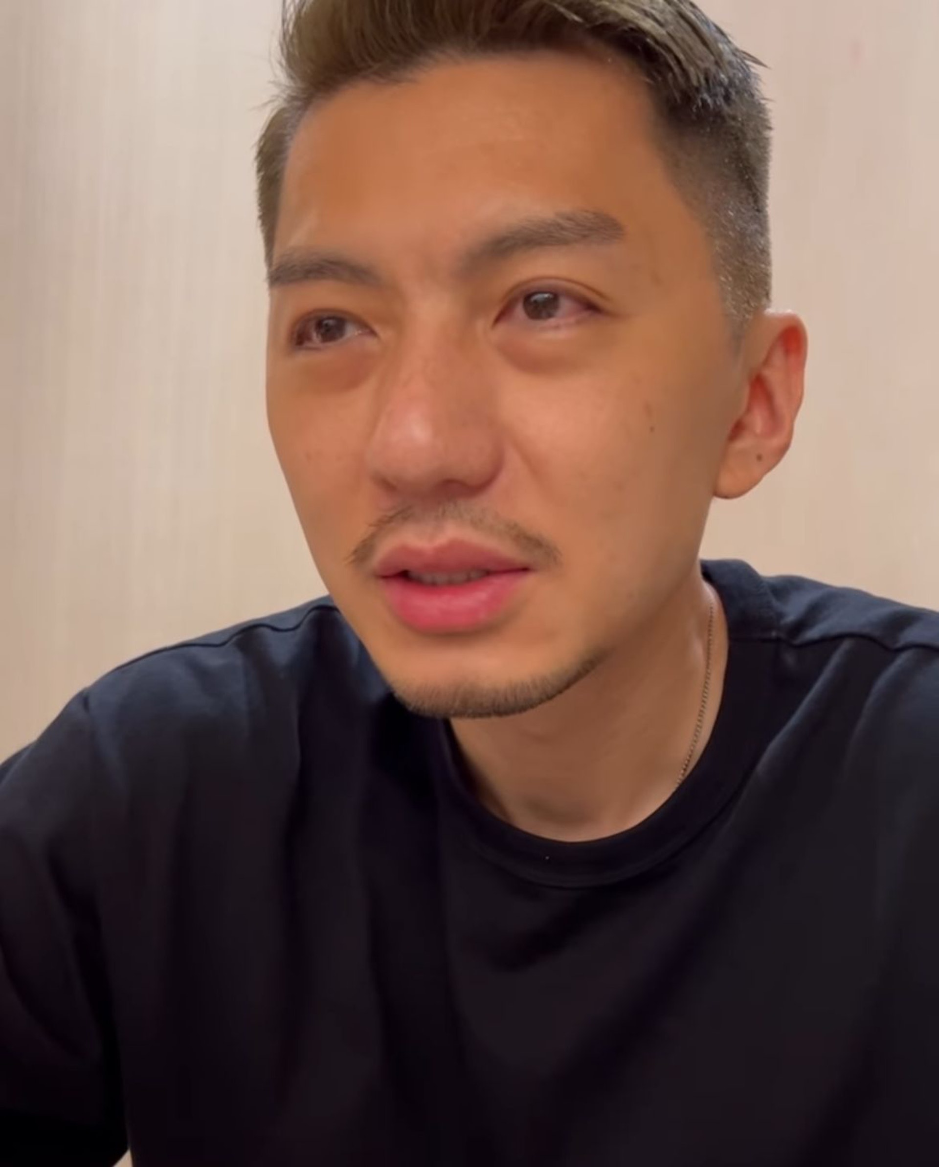 藝人袁偉豪日前拍片表示,自己一次剝掉三隻智慧齒,暫時只能進食流質食物。