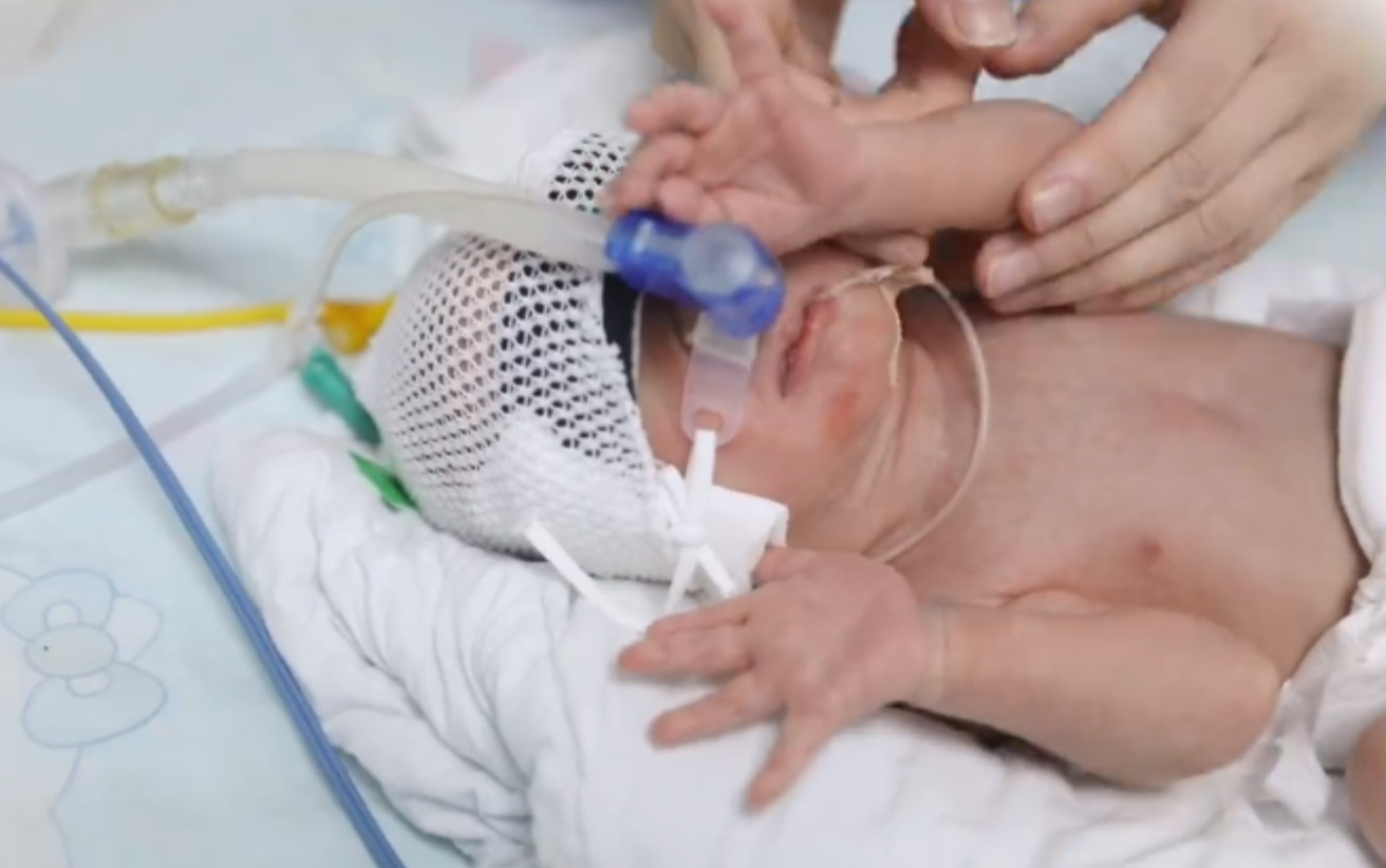 經過新生兒科的治療,男嬰的生命體徵平穩。