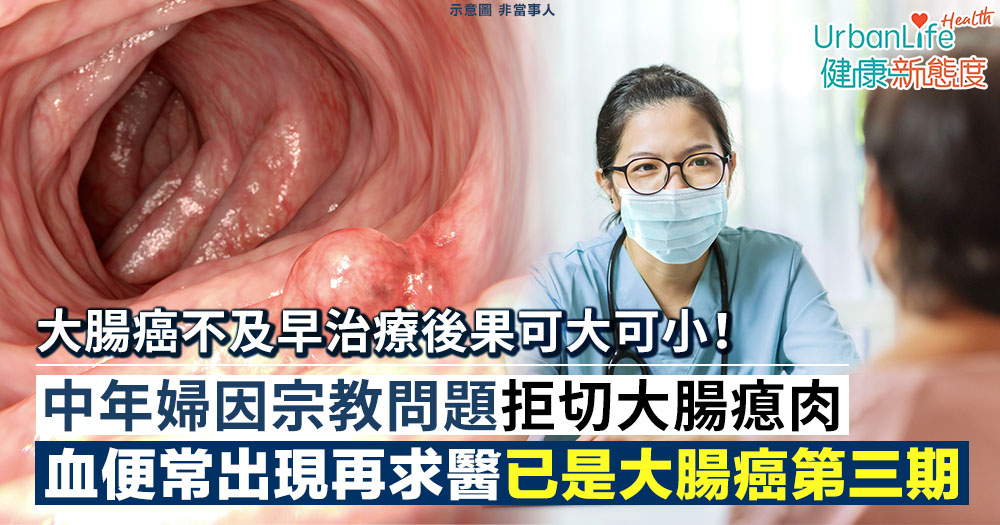 【大腸癌】中年婦因宗教問題拒切大腸瘜肉 血便常出現再求醫已是大腸癌第三期