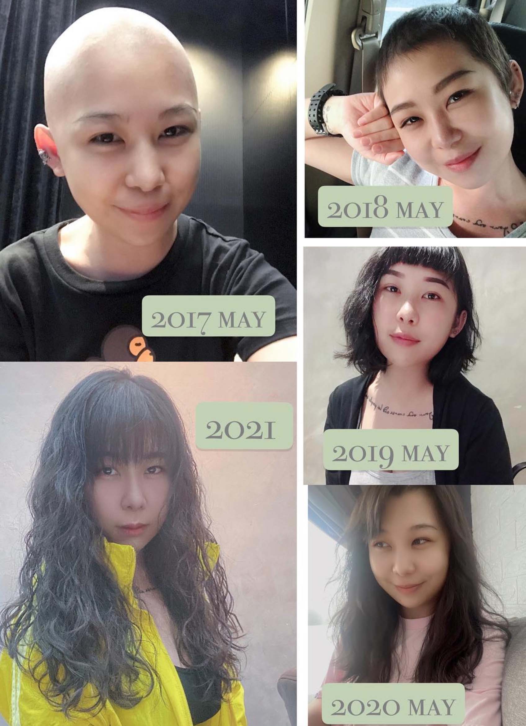 張寶儀希望以自己的力量鼓勵其他癌症患者。