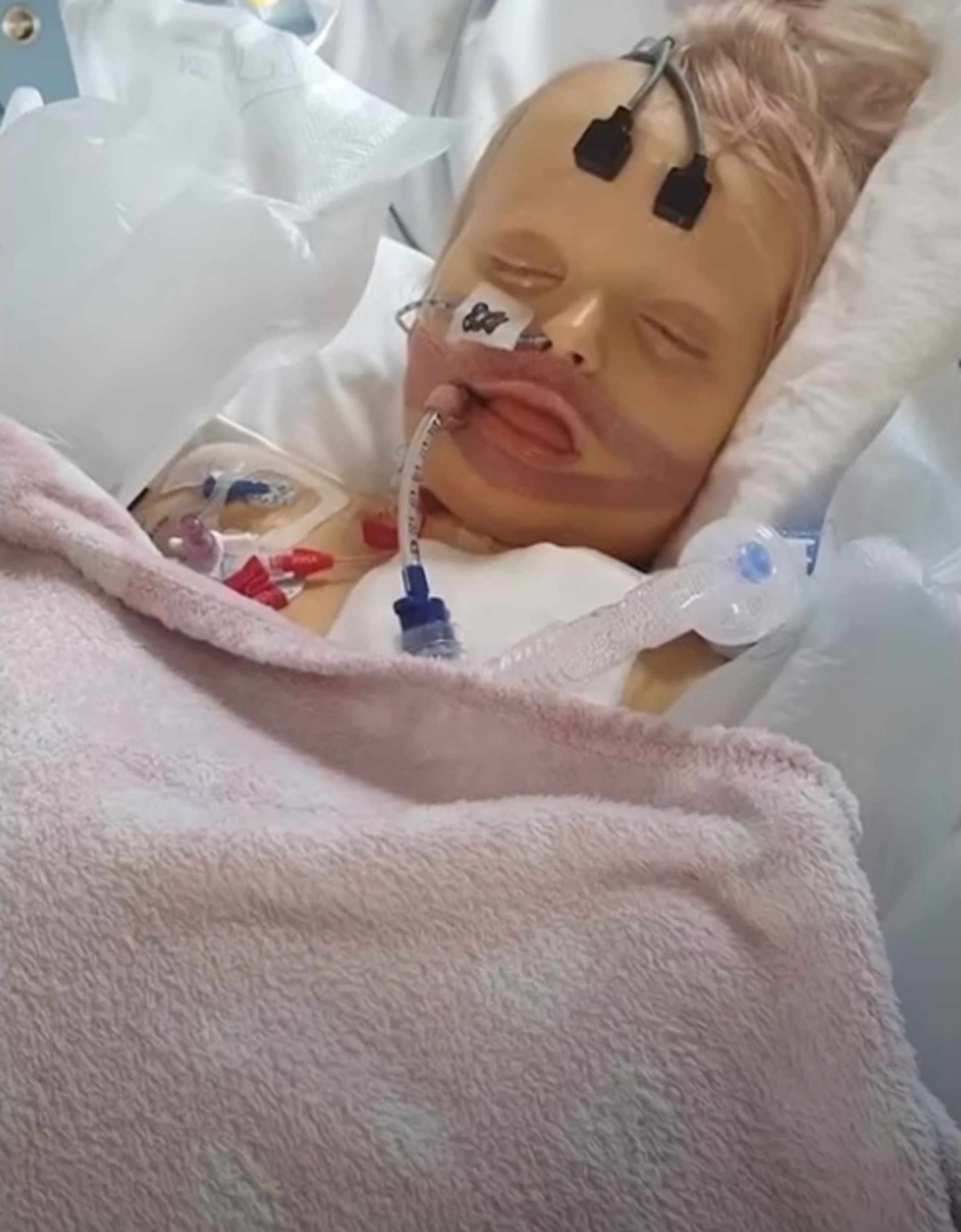 20220429_UL_年僅3歲的女童Lola-Rose Raine患上不明原因兒童肝炎。