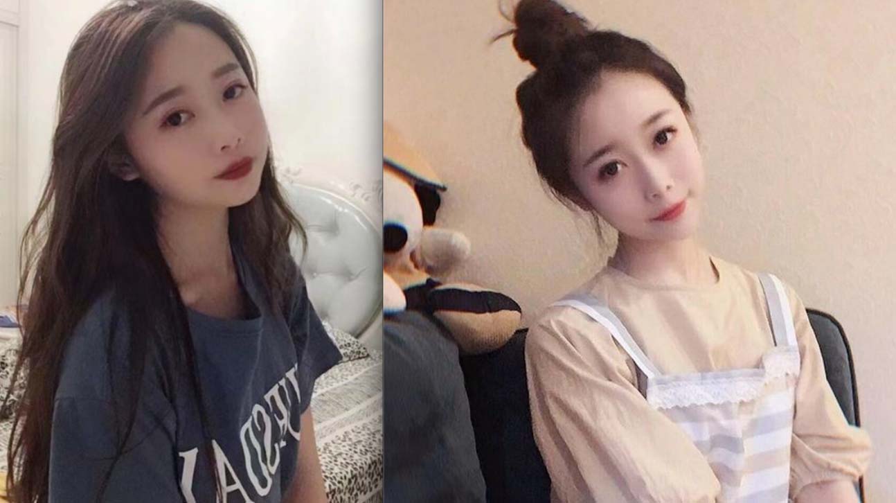 21歲少女因車禍致毁容截肢。