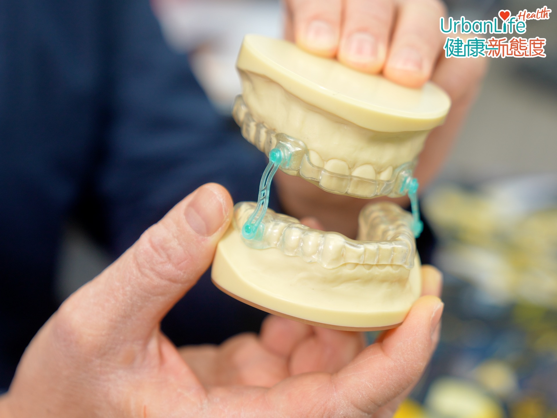 如患者原來是下顎天生短小,睡覺時向下移動,或者是舌頭向下壓阻塞氣管的話,可以考慮使用牙膠。