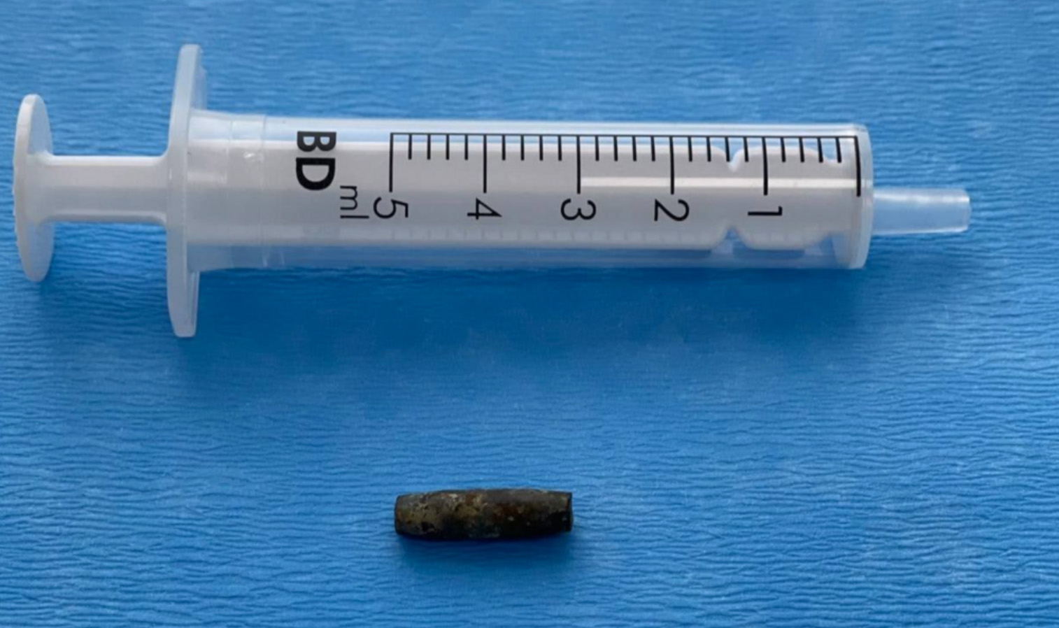 經歷長達5小時的手術，最終成功取出彈頭。