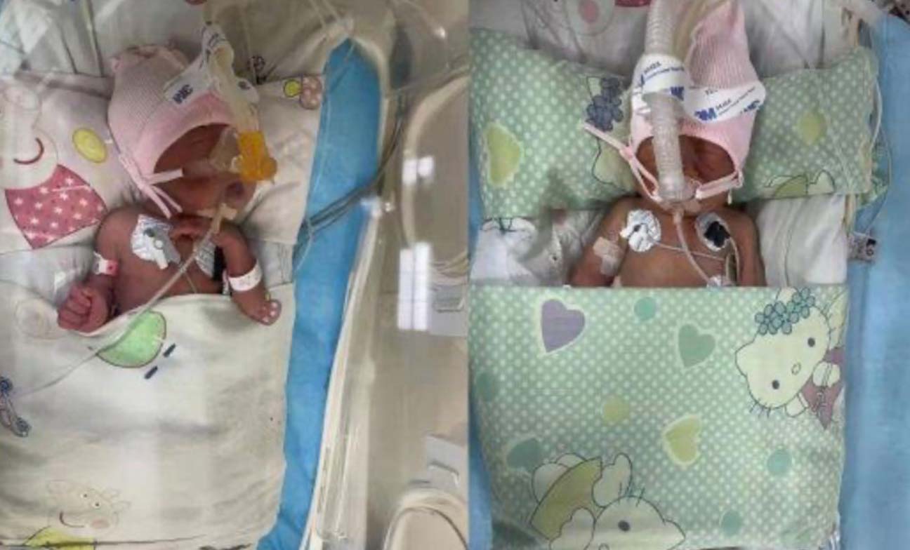 河南安陽的早產雙胞胎小燁和小煜均患有新生兒呼吸窘迫綜合症、新生兒敗血症、呼吸衰竭、先天性肺炎等疾病。