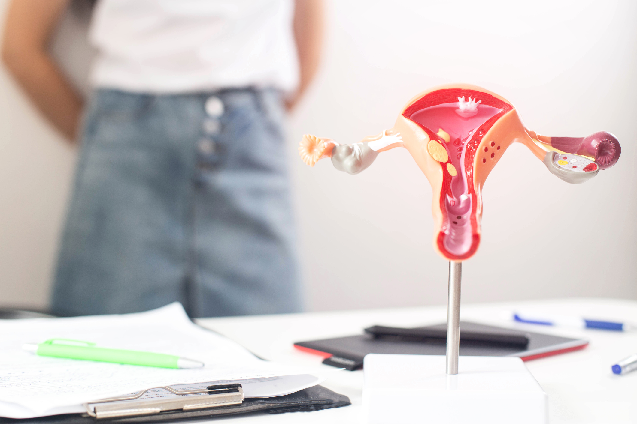 多囊卵巢綜合症是一種十分常見的內分泌疾病。