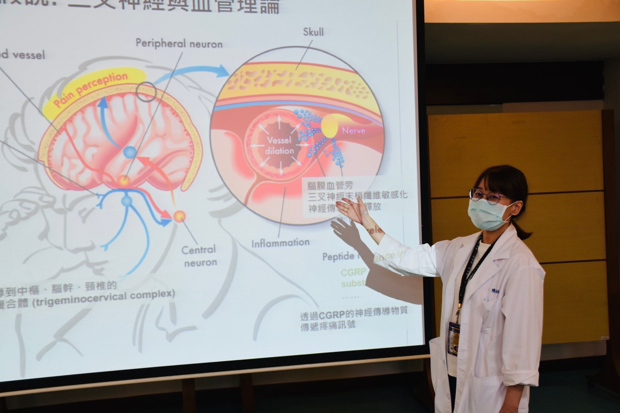 台南市立醫院神經內科醫生陳柏妤表示,偏頭痛是一種跟血管、神經傳導物質相關的頭痛,雖然叫作「偏」頭痛,但也有可能發生在頭的雙側。