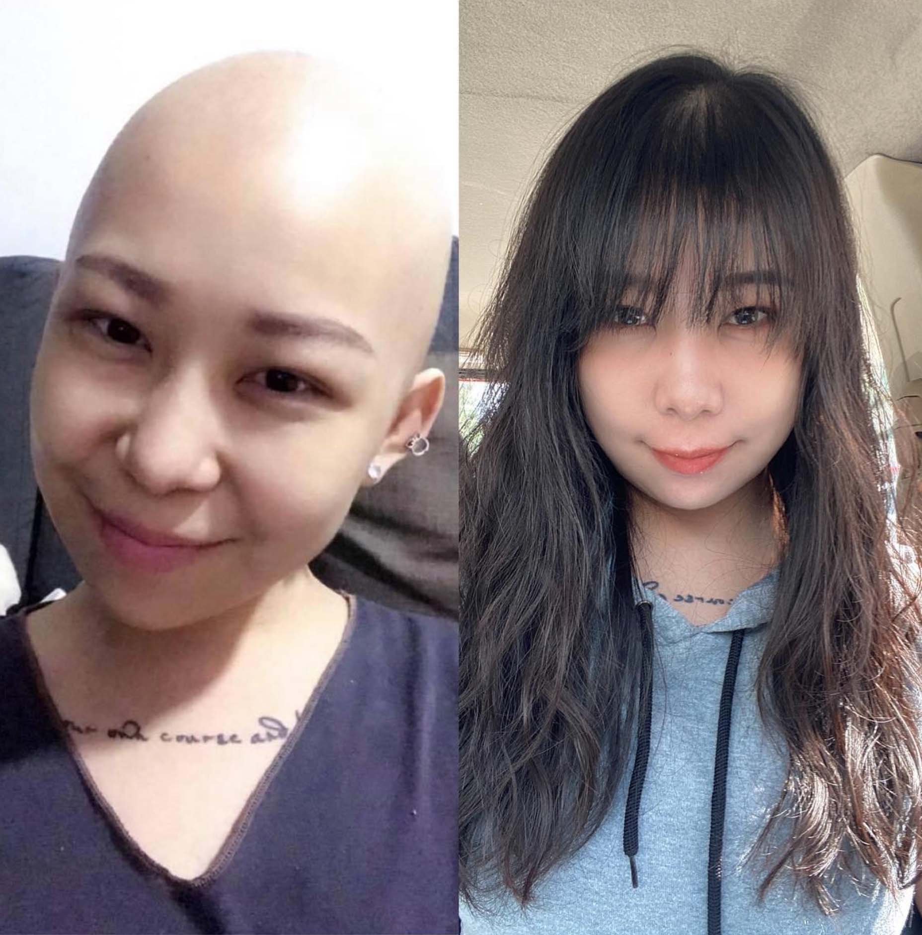 張寶儀在27歲那年確診末期淋巴癌。