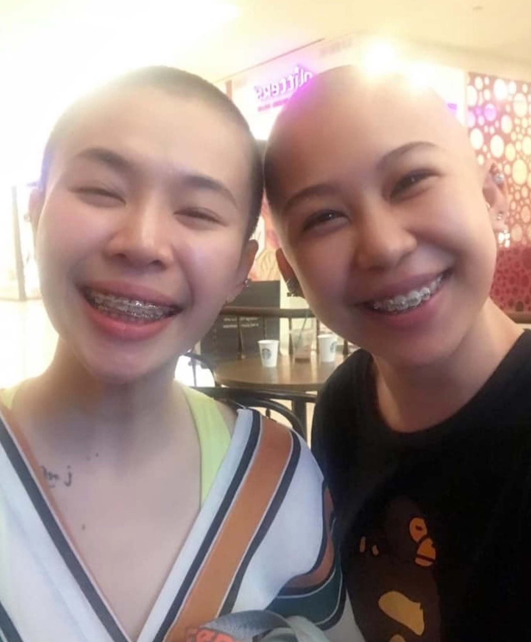 張寶儀的朋友得知她不捨得長髮，當時有24個朋友，包括她的妹妹和表妹都一同陪著她一起剃了頭。