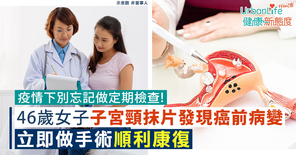 【子宮頸癌】疫情下別忘記做定期檢查!46歲女子做子宮頸抹片發現癌前病變 即做手術順利康復