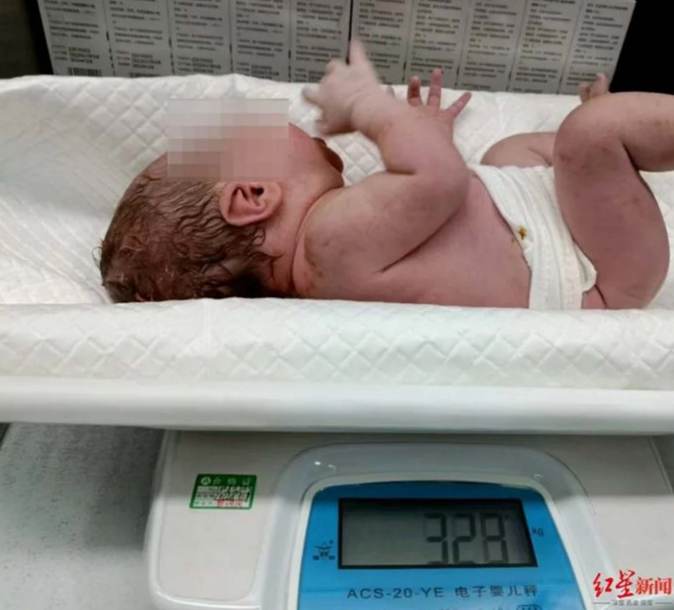 正常新生兒體重約3公斤。