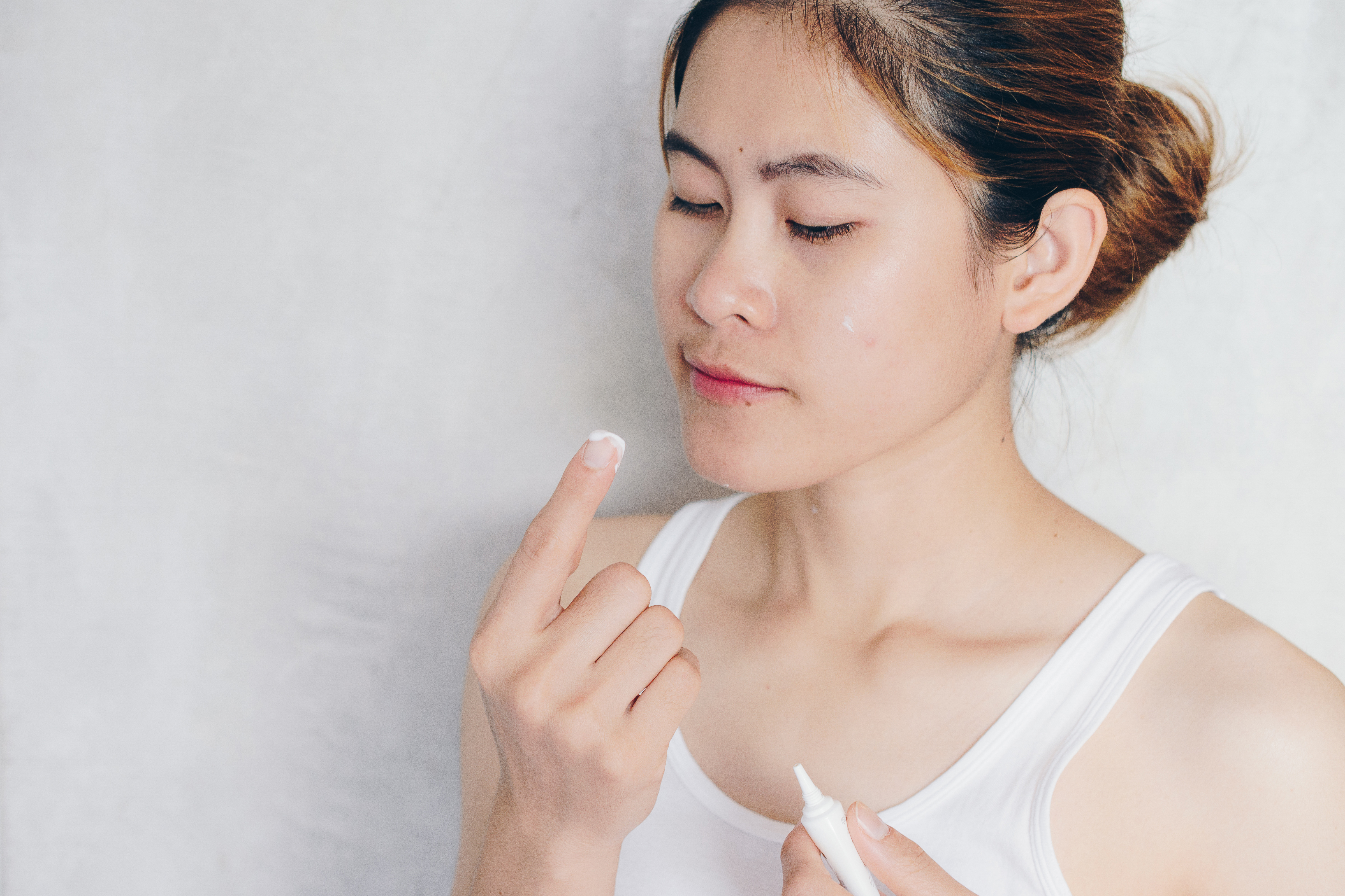 鄺士山指，有暗瘡的人士，可搽含有benzoyl peroxide的暗瘡膏，含有其他維生素、抗氧化劑的藥膏不見得更有效。