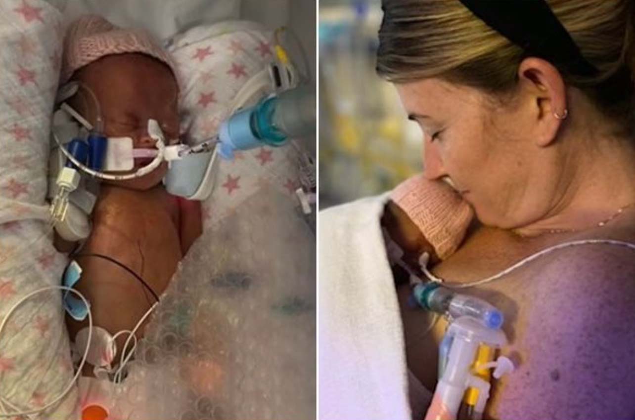 英國34歲孕婦因未打新冠疫苗不慎染疫,導致病毒侵蝕胎盤被迫在25周緊急剖腹早產。