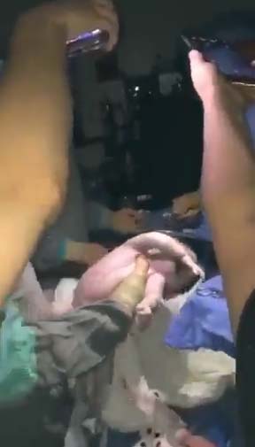 僅用3部手提電話的電筒照明，並按原定計劃為Karla進行剖腹產手術。