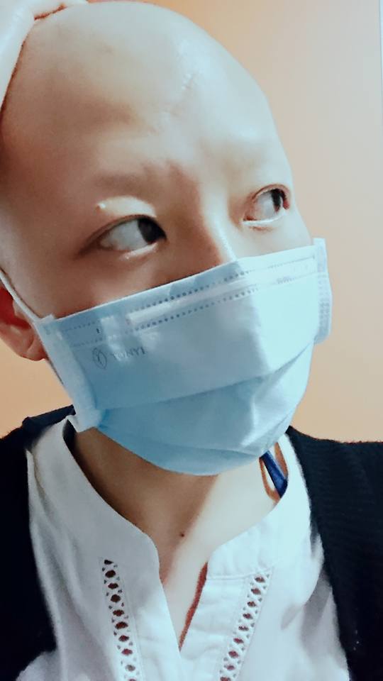 在第一次乳癌化療後,她的身體呈非常強烈的排斥,強烈化療副作用造成眉毛、頭髮等全身毛髮掉光。