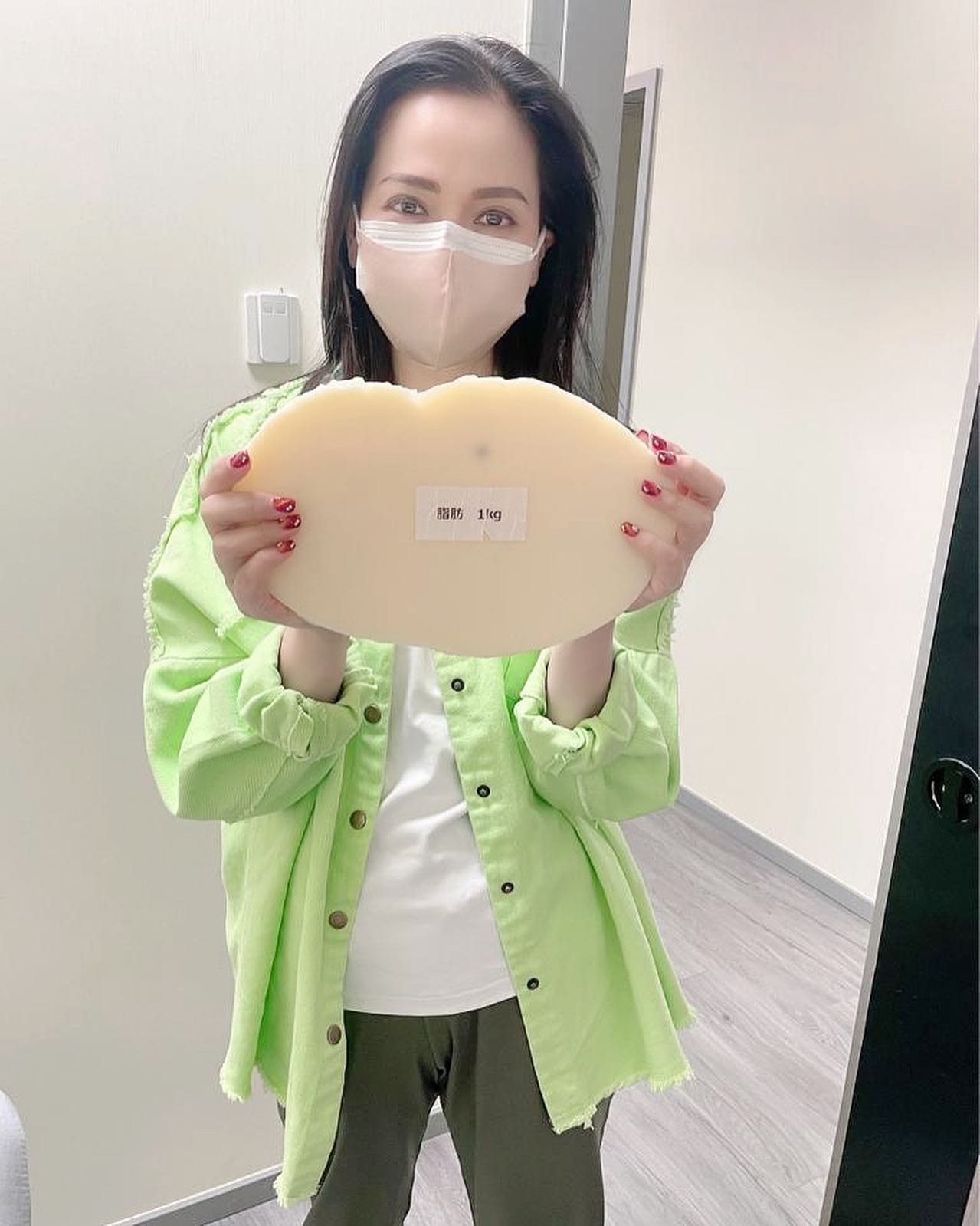 最近樊亦敏在Facebook大晒減肥成功照,她說,早前的20多公斤內,亦成功減了8公斤脂肪。