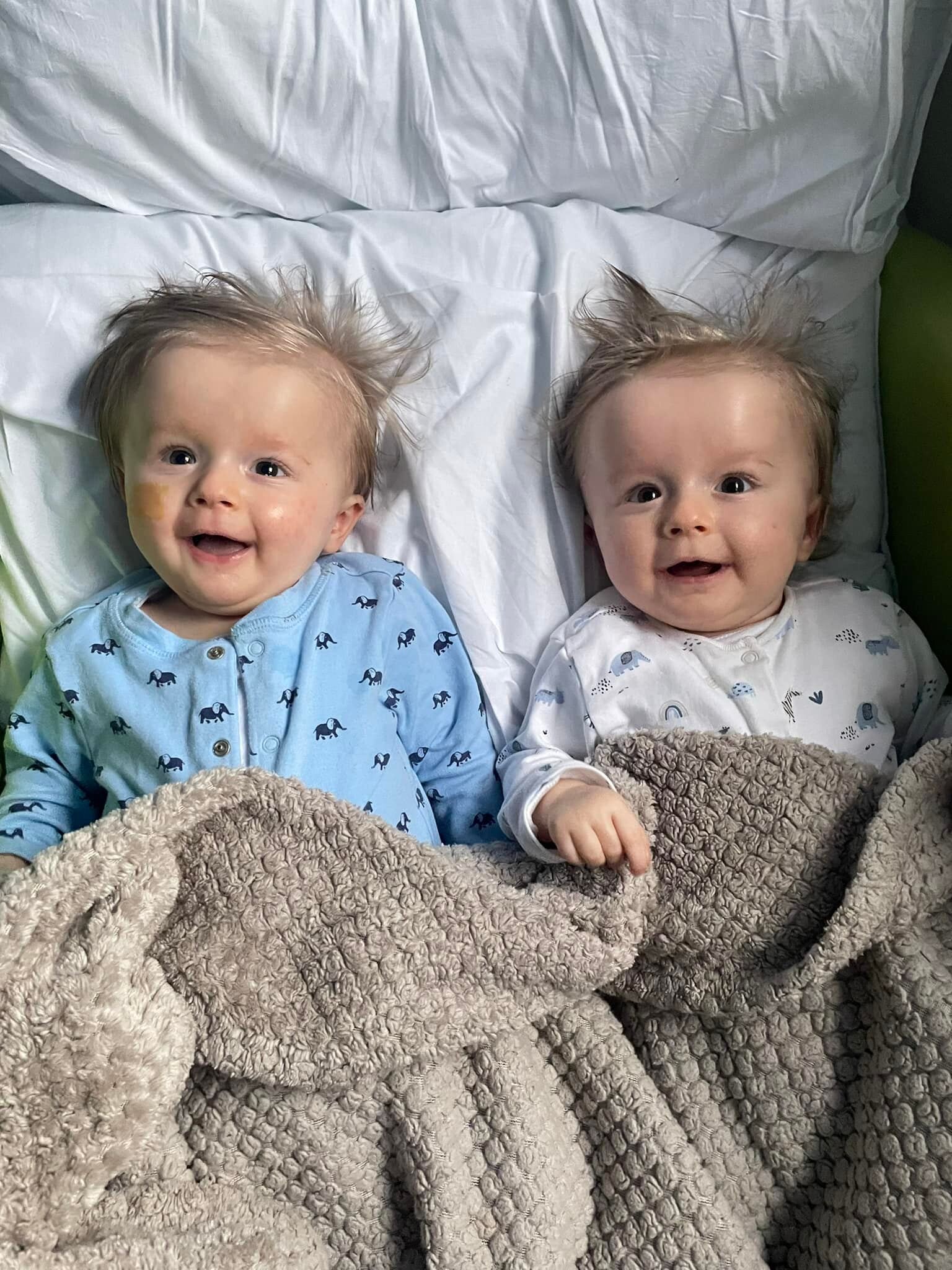 英國一對父母於去年4月生下雙胞胎,但隨着孩子慢慢長大,他們意識到較其他小朋友,甚少抬頭、翻身,這不禁讓他們有些擔心。