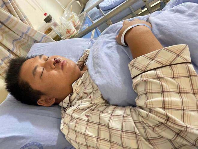 內地四川宜賓一名爸爸唐海濤在5年前不幸患上結外NK/T細胞淋巴瘤（鼻型）。