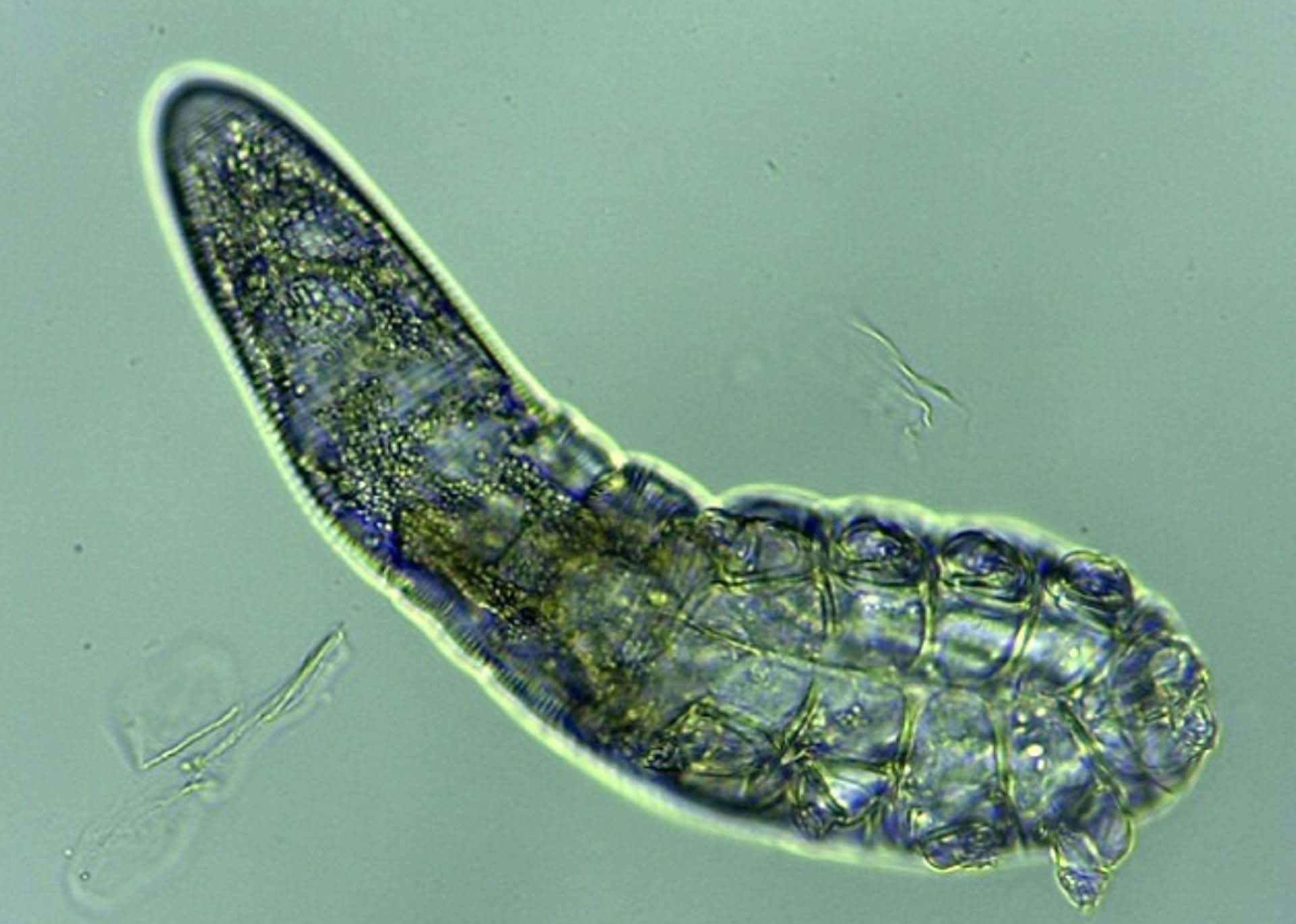 新的研究又證實牠們確實有肛門,並指出蟎蟲被歸因於導致發炎的狀況屬不公平的指控。