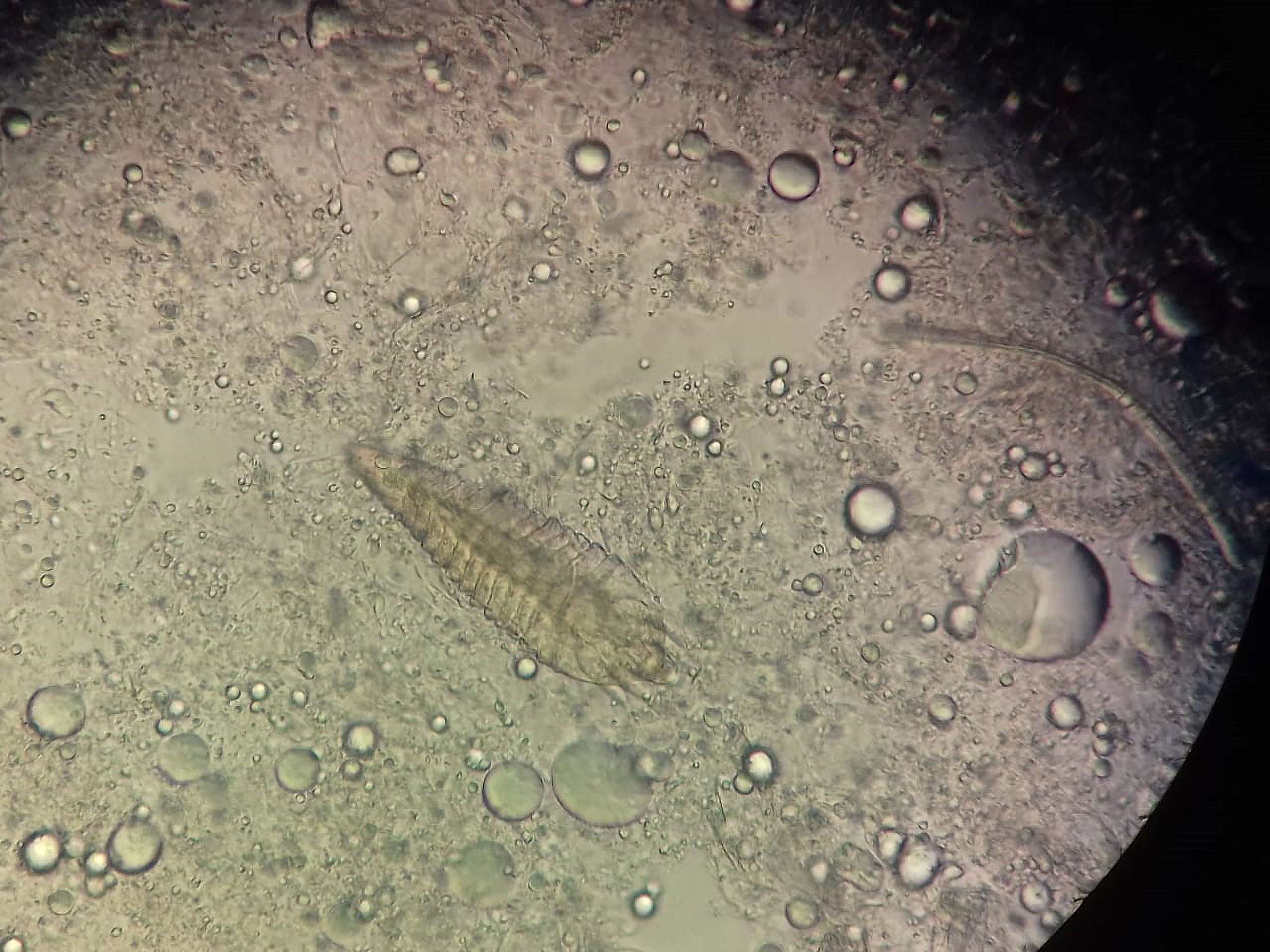 「毛囊蠕形蟎」(Demodex folliculorum),是一種生長在哺乳動物毛囊皮脂腺(pilosebaceous units)的節肢動物。