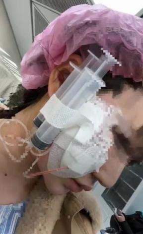 醫生亦曾透露，指細菌會伴隨她一輩子。