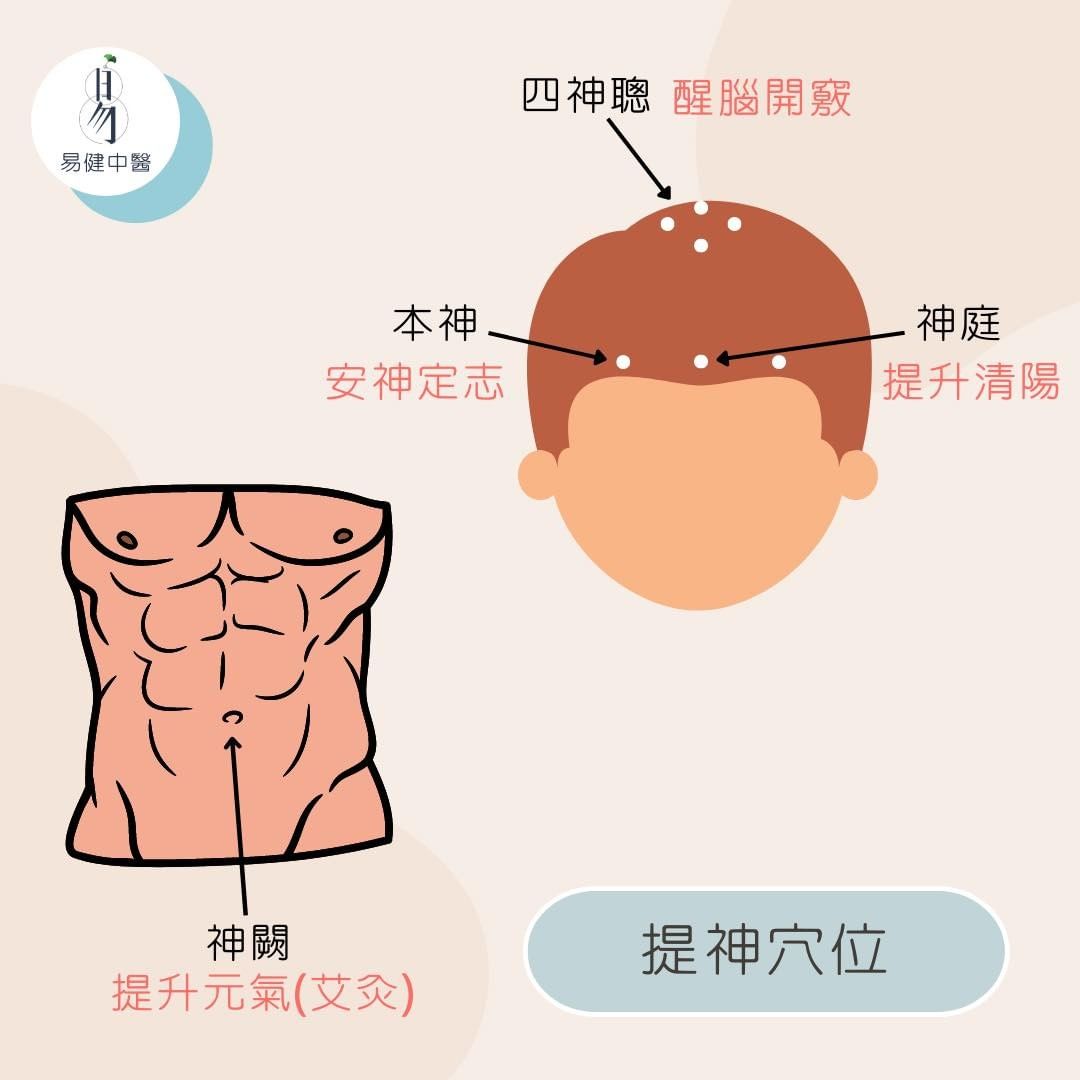 神聰穴,又名四神聰。