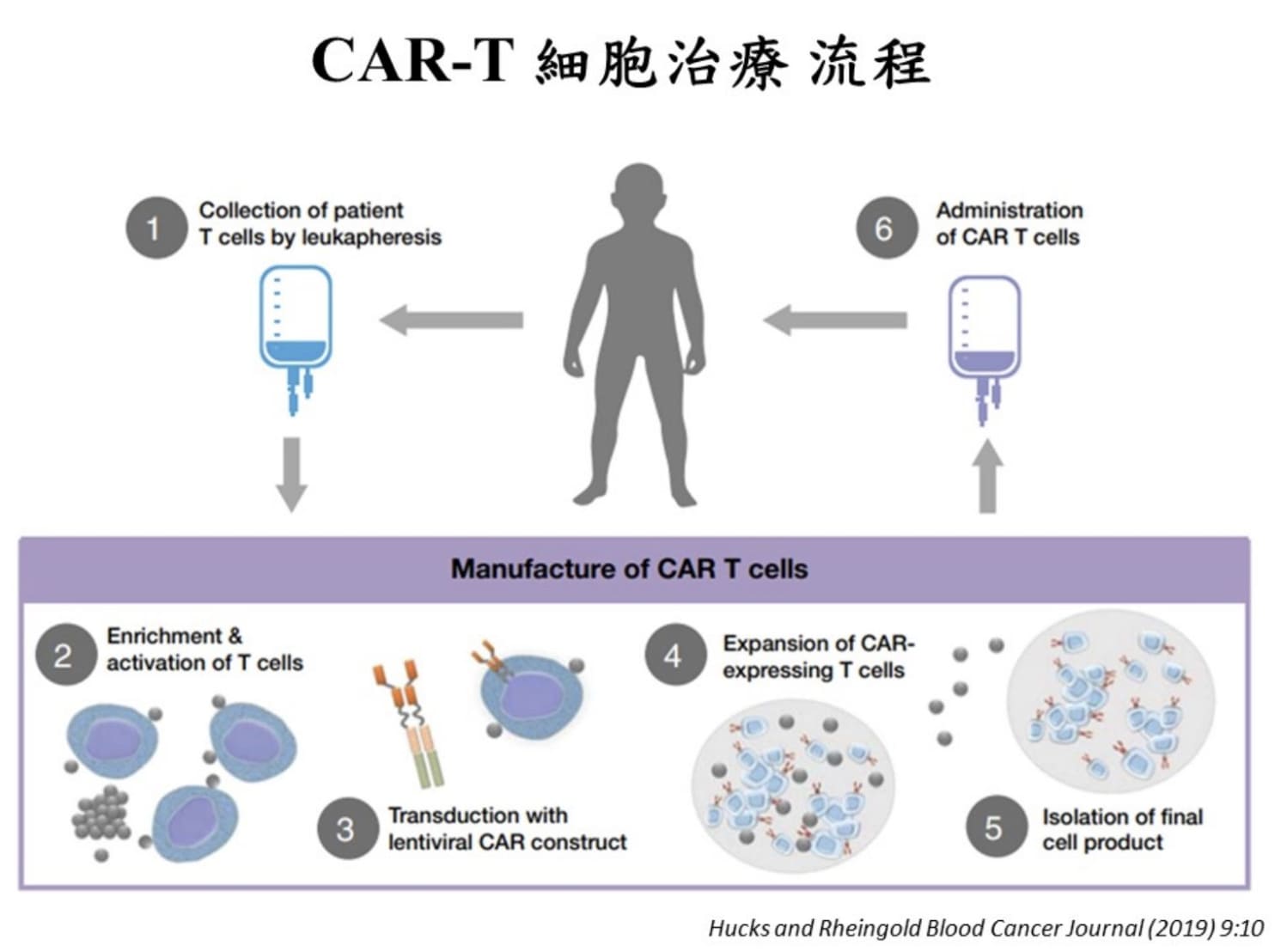 進行CAR-T細胞治療要先取出患者的T細胞,改造後輸注回體內。