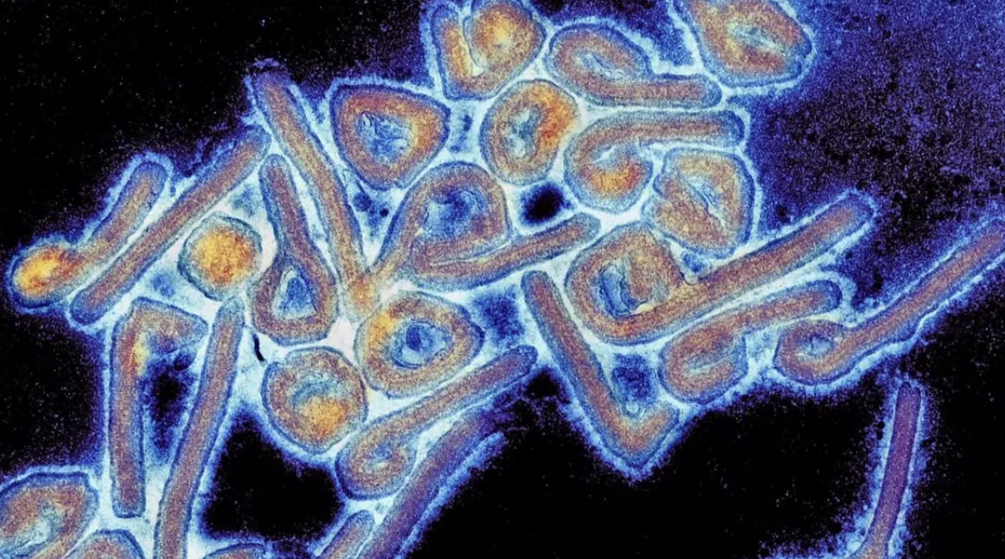 西非國家加納(Ghana)日前(17日)確認出現2宗馬爾堡病毒(Marburg Virus)感染病例,2人均已死亡。