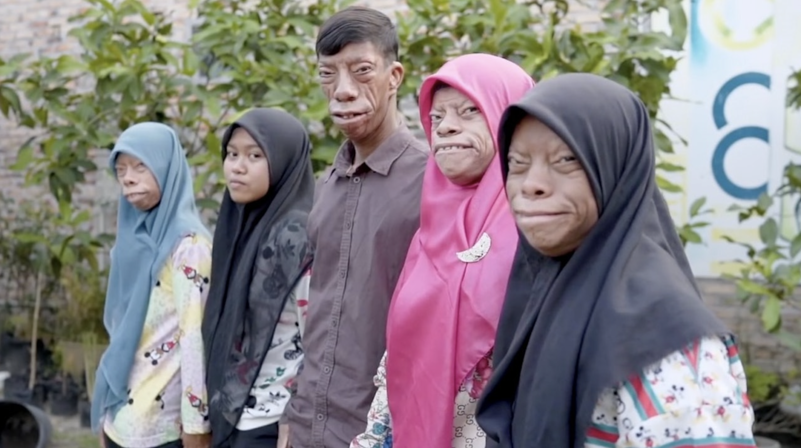 印尼5兄妹的照片在網上引起熱議,因為當中有4人長相異於常人。