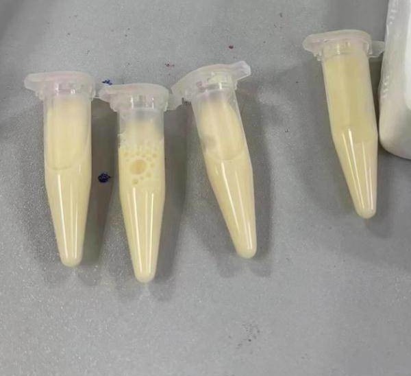 孕婦被抽出來的血液竟全是「牛奶血」。