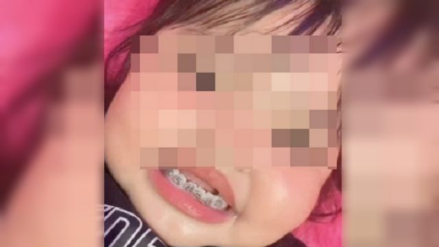 印尼一名媽媽竟為3歲女兒戴上鋼牙箍。