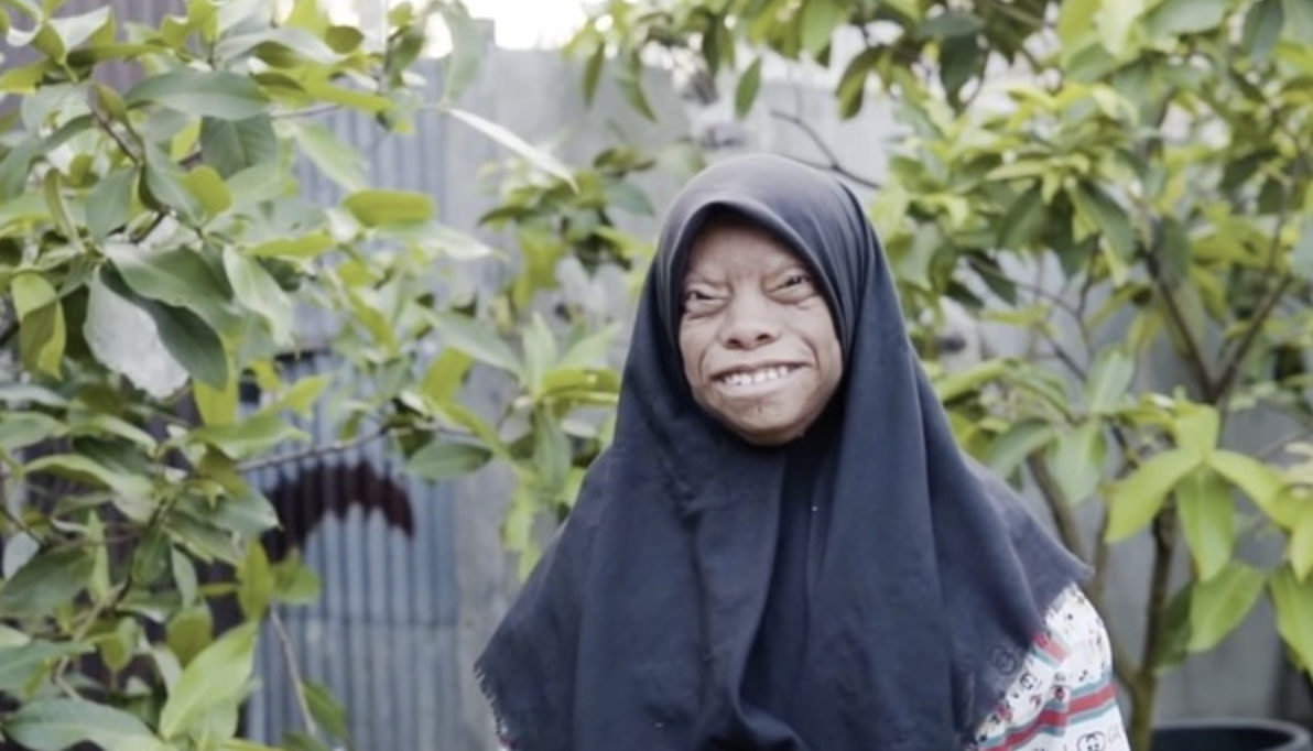 他們接受了自己的外表,當作是「上天的恩賜」。