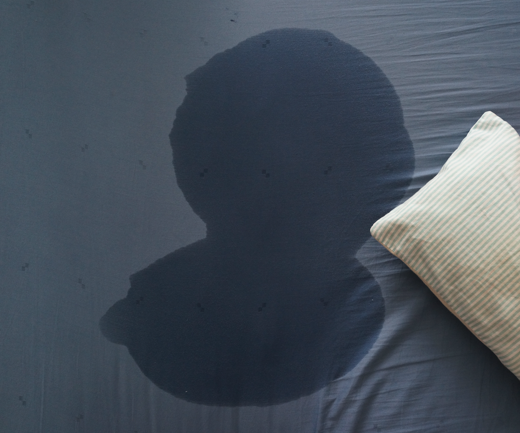 有位患者每天睡覺都會盜汗,嚴重到會讓床單濕一片,還曾被同事誤以為是尿床。(示意圖)