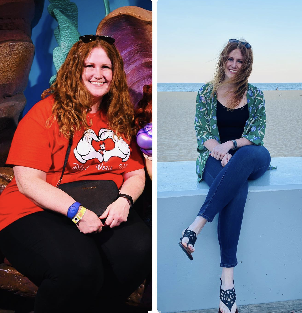 Lauren提出自己想要接受減肥手術的意願。