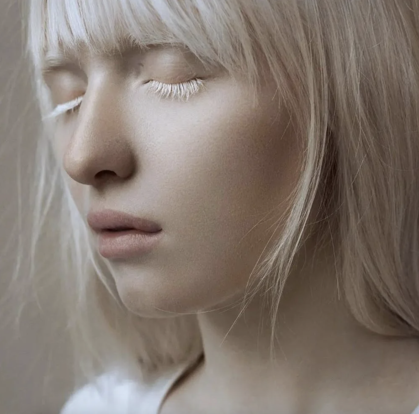 烏克蘭有一名少女因患有白化病,從頭髮到腳都呈現如同天使聖潔般的白色。